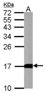 LC3B Antibody in Western Blot (WB)