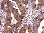 Survivin Antibody in Immunohistochemistry (Paraffin) (IHC (P))