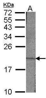 Survivin Antibody in Western Blot (WB)