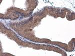 E-cadherin Antibody in Immunohistochemistry (Paraffin) (IHC (P))