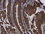 E-cadherin Antibody in Immunohistochemistry (Paraffin) (IHC (P))