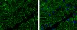 E-cadherin Antibody in Immunohistochemistry (Paraffin) (IHC (P))