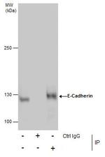 E-cadherin Antibody in Immunoprecipitation (IP)