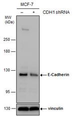 E-cadherin Antibody in Western Blot (WB)