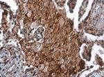 uPAR Antibody in Immunohistochemistry (Paraffin) (IHC (P))