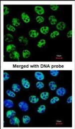 HDAC1 Antibody in Immunocytochemistry (ICC/IF)