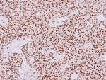 HDAC1 Antibody in Immunohistochemistry (Paraffin) (IHC (P))