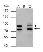 MDM2 Antibody in Immunoprecipitation (IP)