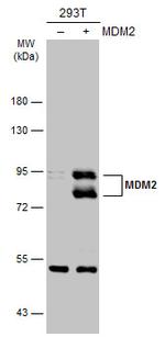 MDM2 Antibody in Western Blot (WB)