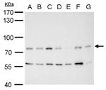 MDM2 Antibody in Western Blot (WB)