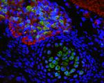 SOD1 Antibody in Immunohistochemistry (Paraffin) (IHC (P))