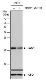 SOD1 Antibody in Western Blot (WB)