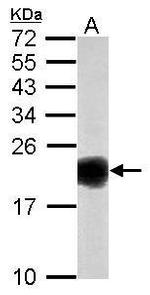 SOD1 Antibody in Western Blot (WB)