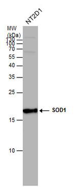 SOD1 Antibody in Western Blot (WB)