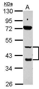 RARB Antibody in Western Blot (WB)