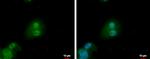 PTHLH Antibody in Immunocytochemistry (ICC/IF)