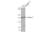 Collagen II Antibody in Western Blot (WB)