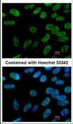 Nanog Antibody in Immunocytochemistry (ICC/IF)