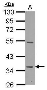 Decorin Antibody in Western Blot (WB)