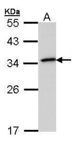 NQO1 Antibody in Western Blot (WB)