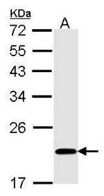 BID Antibody in Western Blot (WB)