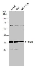 CCR5 Antibody in Western Blot (WB)