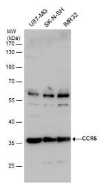 CCR5 Antibody in Western Blot (WB)