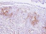 Calcium Sensing Receptor Antibody in Immunohistochemistry (Paraffin) (IHC (P))