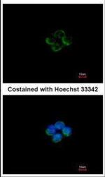 ACADM Antibody in Immunocytochemistry (ICC/IF)