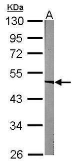 ACADM Antibody in Western Blot (WB)