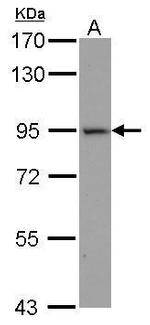 ACE2 Antibody in Western Blot (WB)