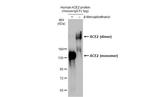 ACE2 Antibody in Western Blot (WB)