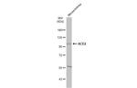 ACE2 Antibody in Western Blot (WB)