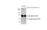 ACE2 Antibody in Western Blot (WB)