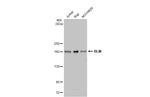 Blooms Syndrome Antibody in Western Blot (WB)