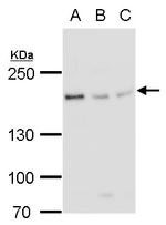 Blooms Syndrome Antibody in Western Blot (WB)