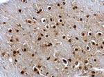 SOX2 Antibody in Immunohistochemistry (Paraffin) (IHC (P))