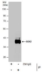 SOX2 Antibody in Immunoprecipitation (IP)