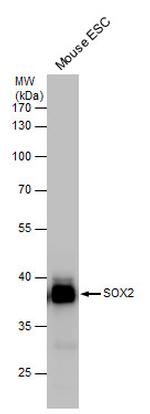 SOX2 Antibody in Western Blot (WB)