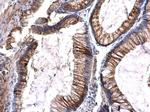 FLT3 Antibody in Immunohistochemistry (Paraffin) (IHC (P))