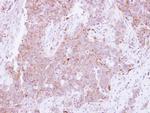 CD81 Antibody in Immunohistochemistry (Paraffin) (IHC (P))