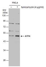 ATF4 Antibody in Western Blot (WB)