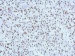 POM121 Antibody in Immunohistochemistry (Paraffin) (IHC (P))