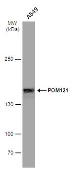 POM121 Antibody in Western Blot (WB)