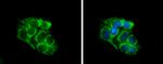 SLC25A1 Antibody in Immunocytochemistry (ICC/IF)