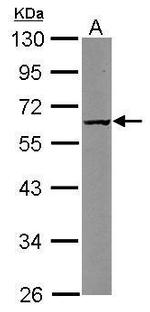 CARD8 Antibody in Western Blot (WB)