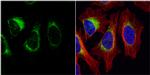 Tyrosine Hydroxylase Antibody in Immunocytochemistry (ICC/IF)