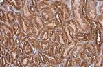 GRP78 Antibody in Immunohistochemistry (Paraffin) (IHC (P))