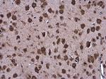 GRP78 Antibody in Immunohistochemistry (Paraffin) (IHC (P))