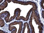 GRP78 Antibody in Immunohistochemistry (Paraffin) (IHC (P))